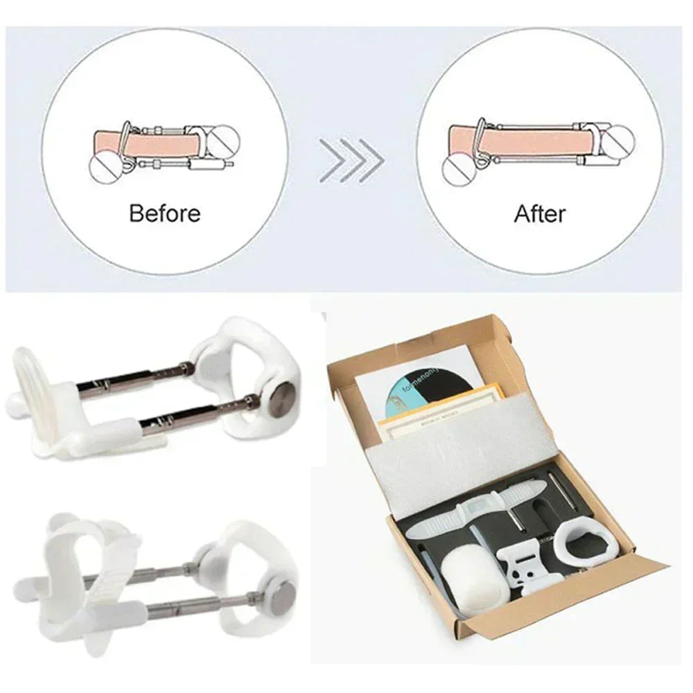 Penile Traction Device Adjustable Tension Screws Stainless Steel