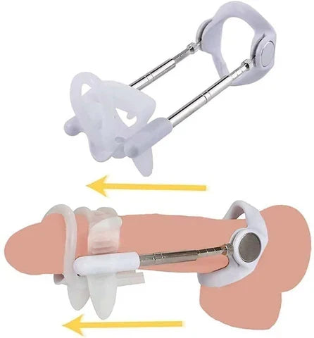 Penile Traction Device Adjustable Tension Screws Stainless Steel